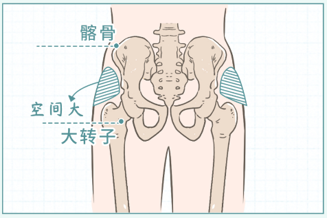 漫画科普：女生大腿太粗，怎么办？