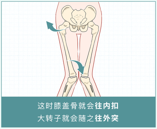 漫画科普：女生大腿太粗，怎么办？