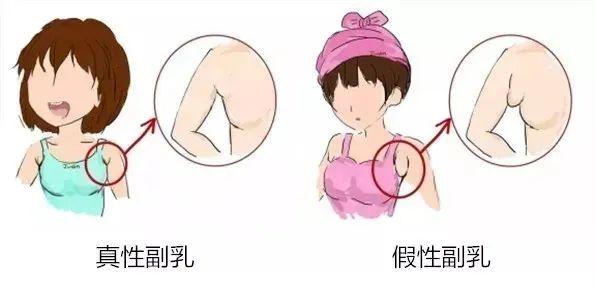 关晓彤“副乳”太明显，身材越来越有料，网友：鹿晗眼光真好