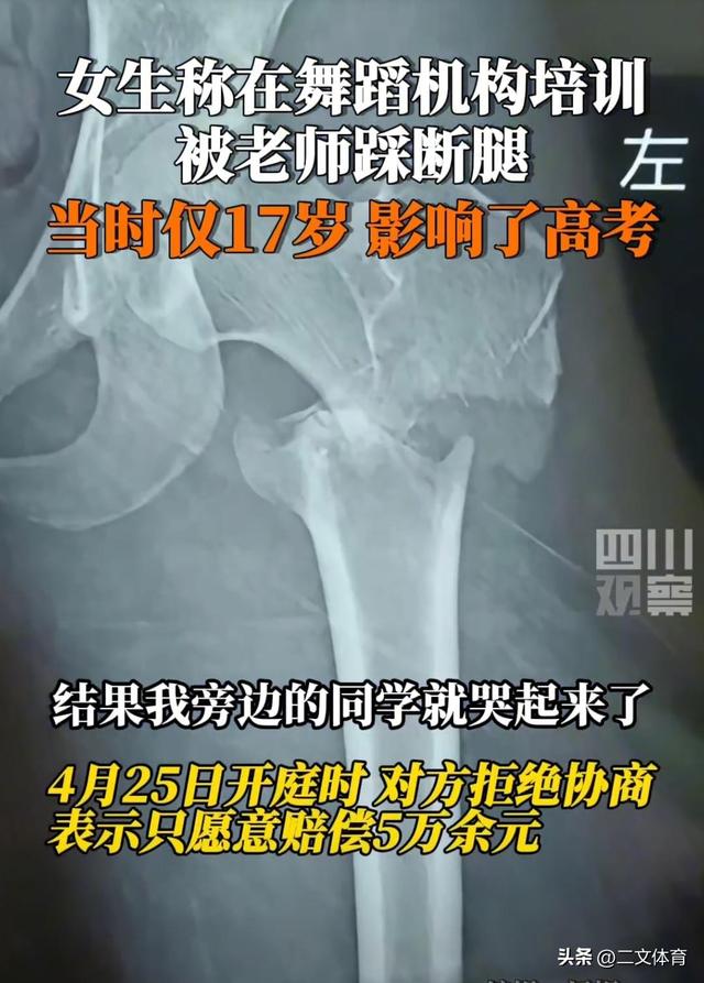 揪心！17岁女孩开胯被舞蹈老师踩断腿，画面曝光，现场听到骨头响