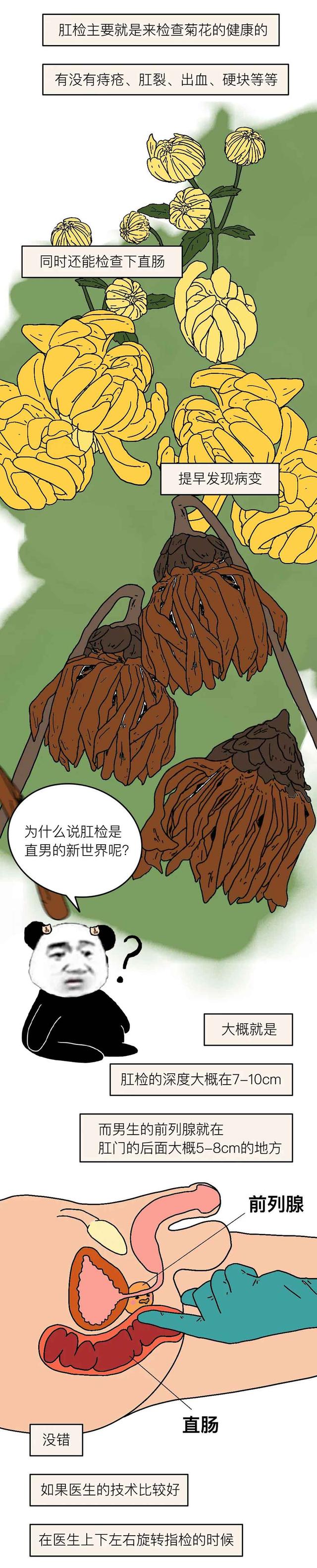 让男人尴尬的“肛门指检”，究竟是什么感觉？漫画解析，太酸爽了