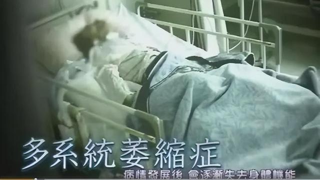 日本女子安乐死全过程：从清醒到结束仅4分钟，一句遗言令人泪目