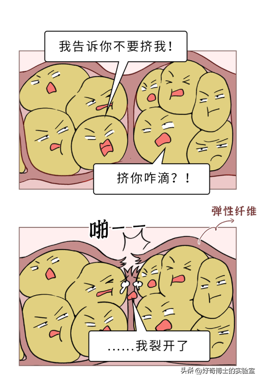 为啥很多女生大腿、屁股附近，会有白色条纹？