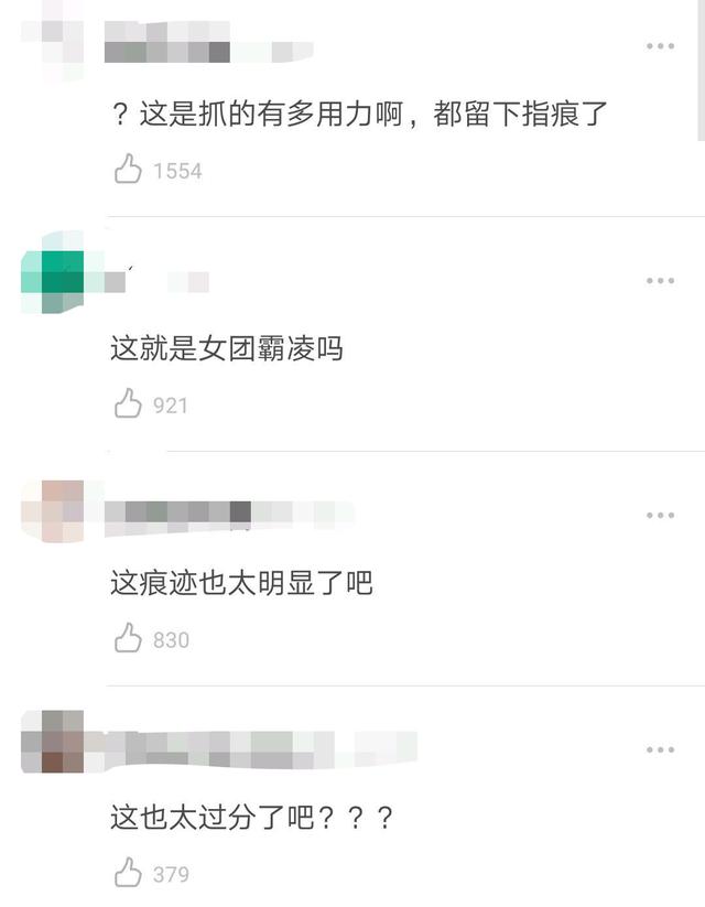 开玩笑还是故意？韩国女团成员演出时抓伤队友，抓痕明显引热议