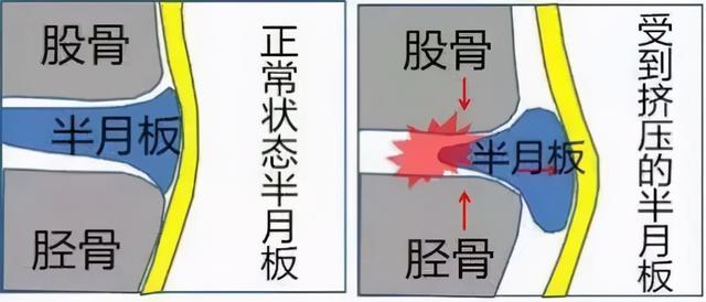 美国小卡戴珊爆红网络！听说看到这个包臀裙的都馋哭了？