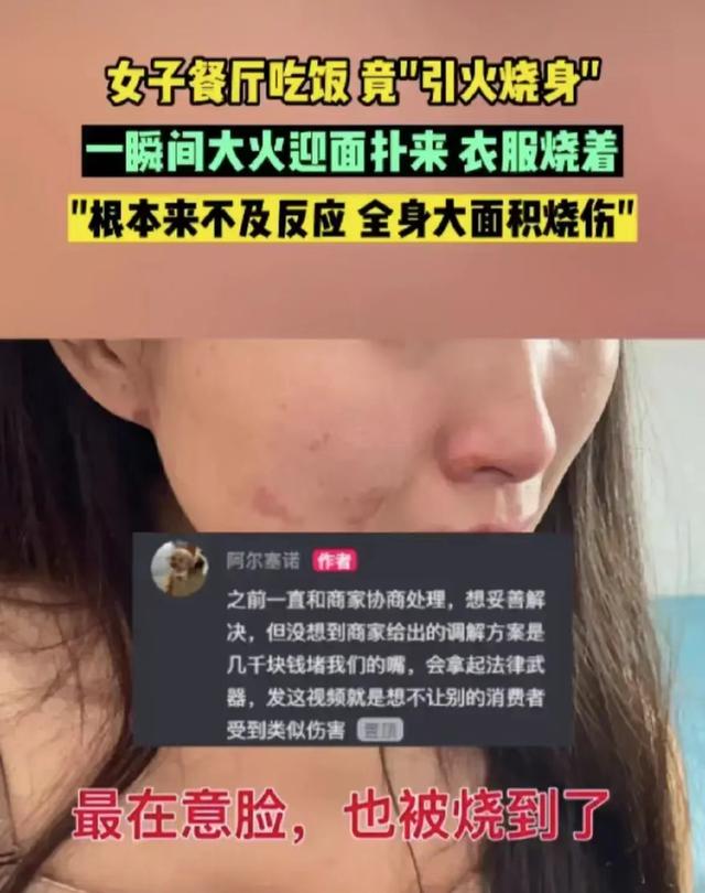 女子餐厅吃饭因厨师失误'引火烧身'商家的处理方式令人质疑