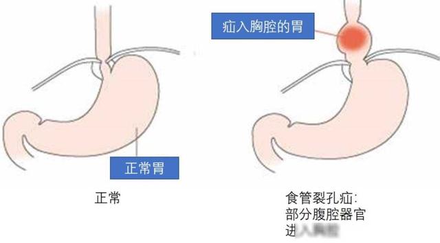 谷爱凌居然把胸勒成这样？！网友：看着十级难受……