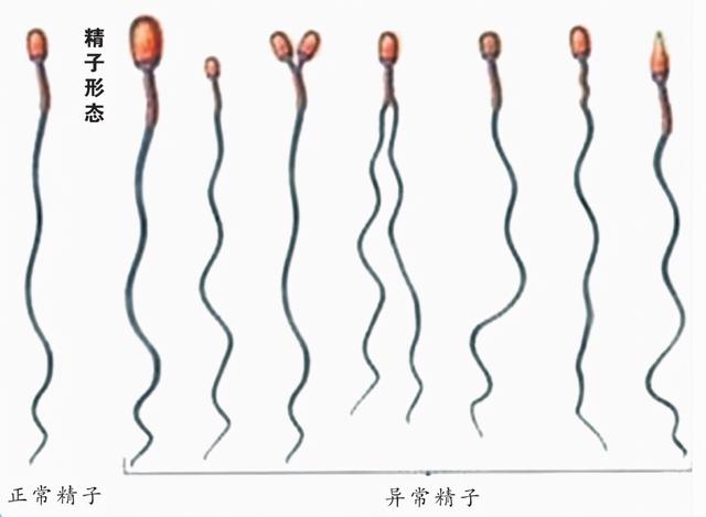 英国女子自己操作人工授精，一次成功！普通人千万不要尝试