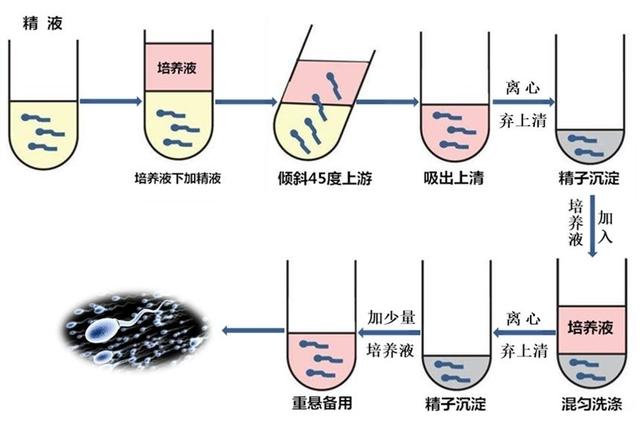 英国女子自己操作人工授精，一次成功！普通人千万不要尝试