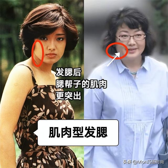 “发腮”对女生颜值影响有多大？看完这3组对比图，你就明白了