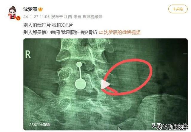 知名女主持人突发意外！