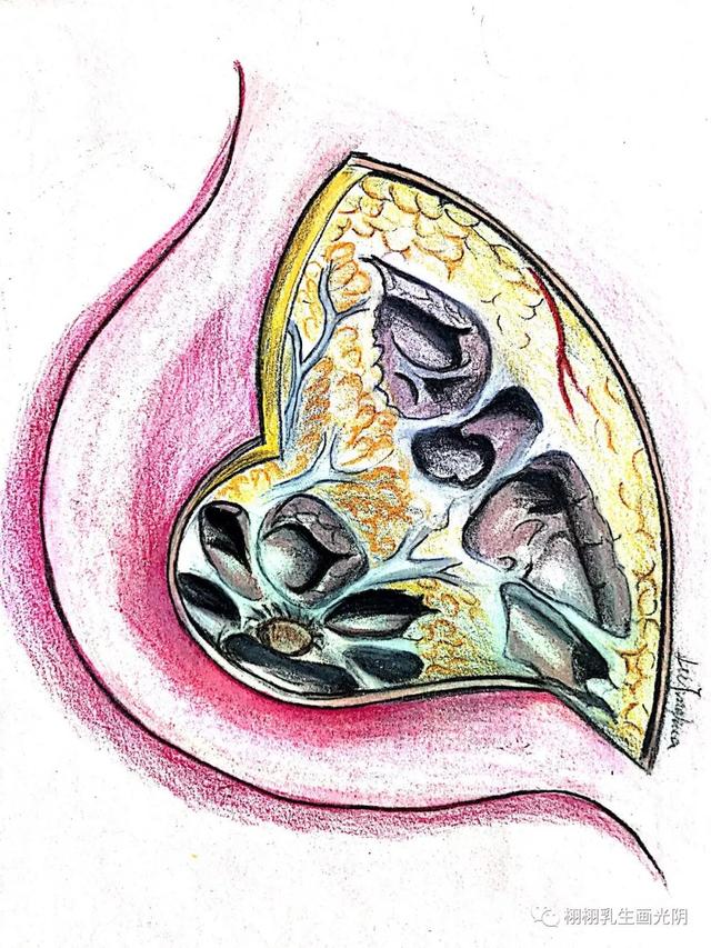 走进最贵的房子-图解乳房结构