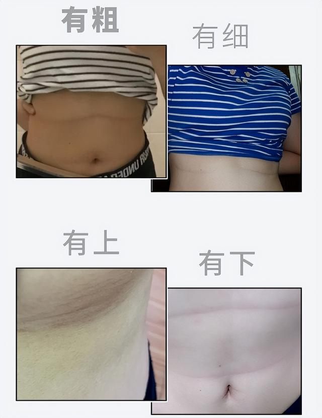 为什么女生的胸部下面，都会有一根“细线”？