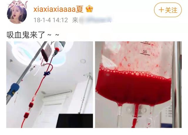 美女网红自曝医美史！花30万换血延缓衰老，美白溶脂全身都做手术