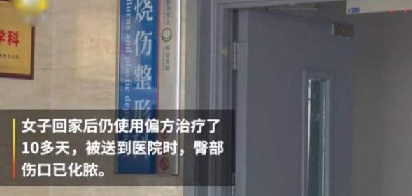 双脚不适误信偏方“土法治疗”，山东女子屁股遭严重烧伤