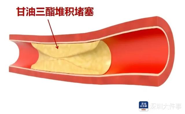 深圳一女子体内抽出“牛奶血”，你敢相信吗？